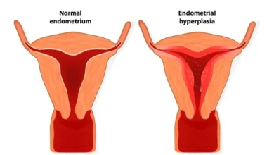 درمان ضخامت رحم بدون کورتاژ 13